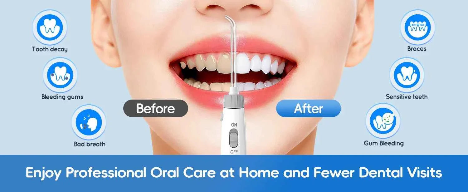Home Water Flosser, 600 ml Large Capacity,10 Adjustable Pressures,6 Home Nozzles Professional Oral Irrigator for Teeth Clean