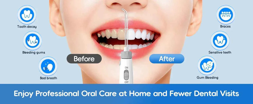 Home Water Flosser, 10 Adjustable Pressures,600 ml Large Capacity,6 Home Nozzles Professional Oral Irrigator for Teeth Clean