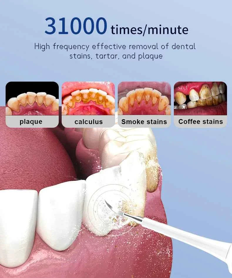 Sonic Electric Teeth Cleaner Dental Calculus Remover Whitening Waterproof Tartar Oral Care Sonic Toothbrush