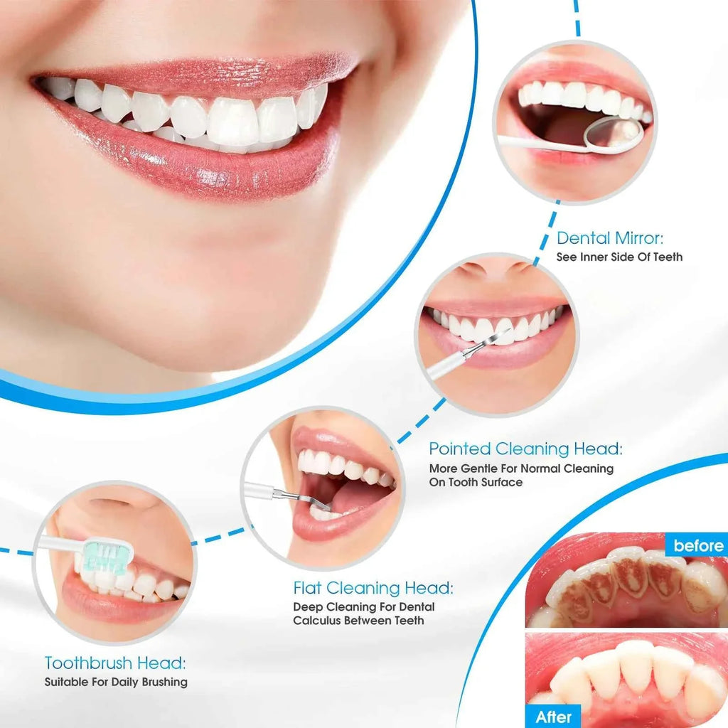 Sonic Electric Teeth Cleaner Dental Calculus Remover Whitening Waterproof Tartar Oral Care Sonic Toothbrush