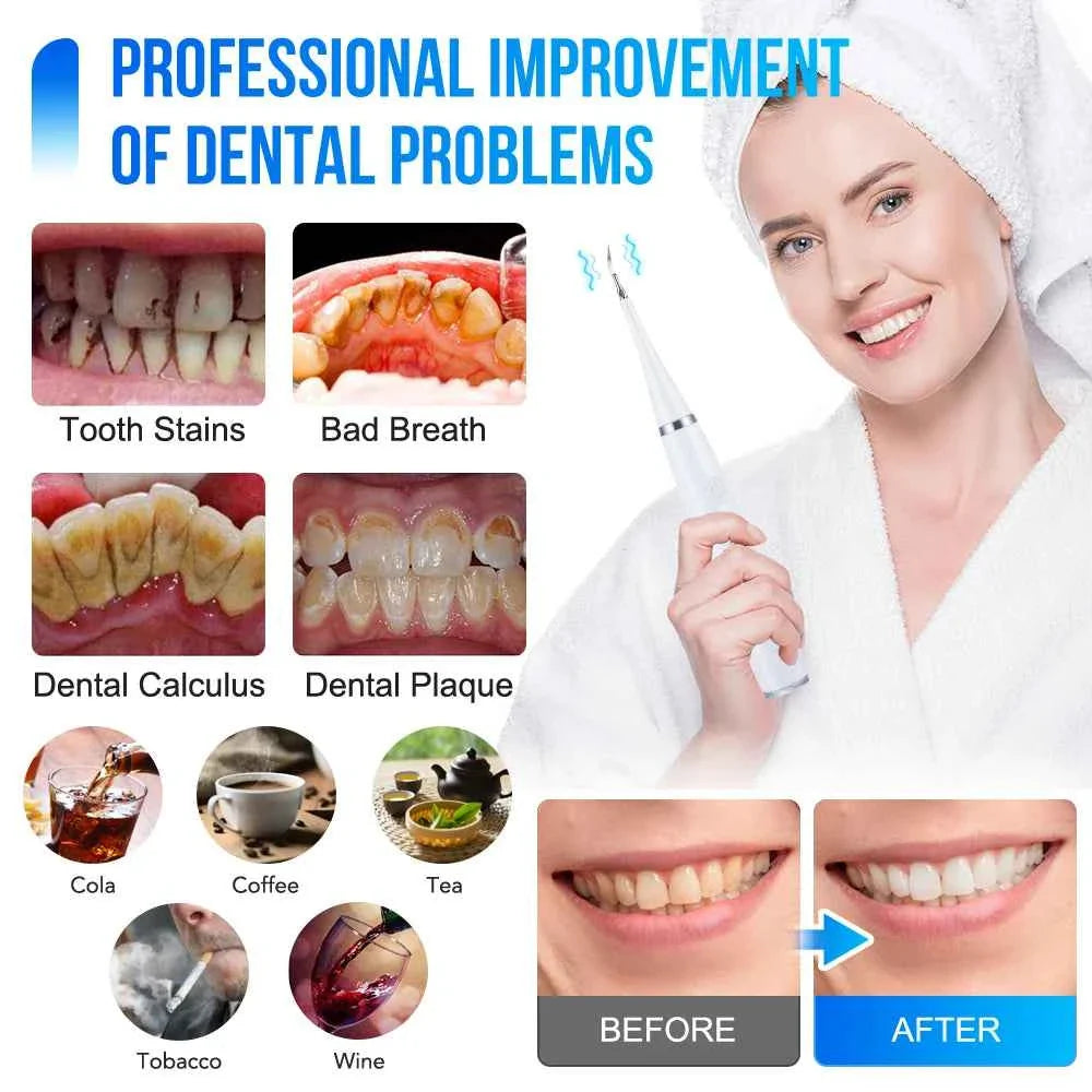 Sonic Electric Teeth Cleaner Dental Calculus Remover Whitening Waterproof Tartar Oral Care Sonic Toothbrush
